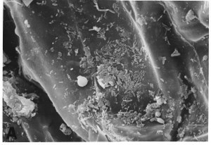 Salud, calidad del suelo y diversidad microbiana (1 parte)