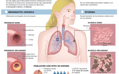 EPOC: más del 80% de los pacientes son fumadores o exfumadores