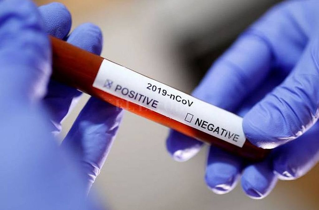 Confirmaron el primer caso de coronavirus en la Argentina