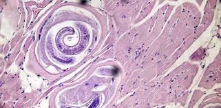 Prevención de enfermedades que se transmisten de los animales a las personas